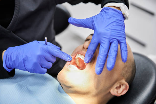 Best Knocked-Out Tooth (Avulsed Tooth) Treatment in Edgerton, OH